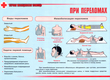 ПВ05 Первая помощь при чрезвычайных ситуациях (самокл.пленка, А3, 9 листов) - Плакаты - Медицинская помощь - . Магазин Znakstend.ru